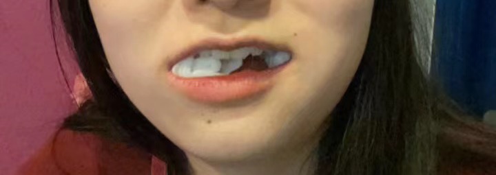 智齿太受罪了