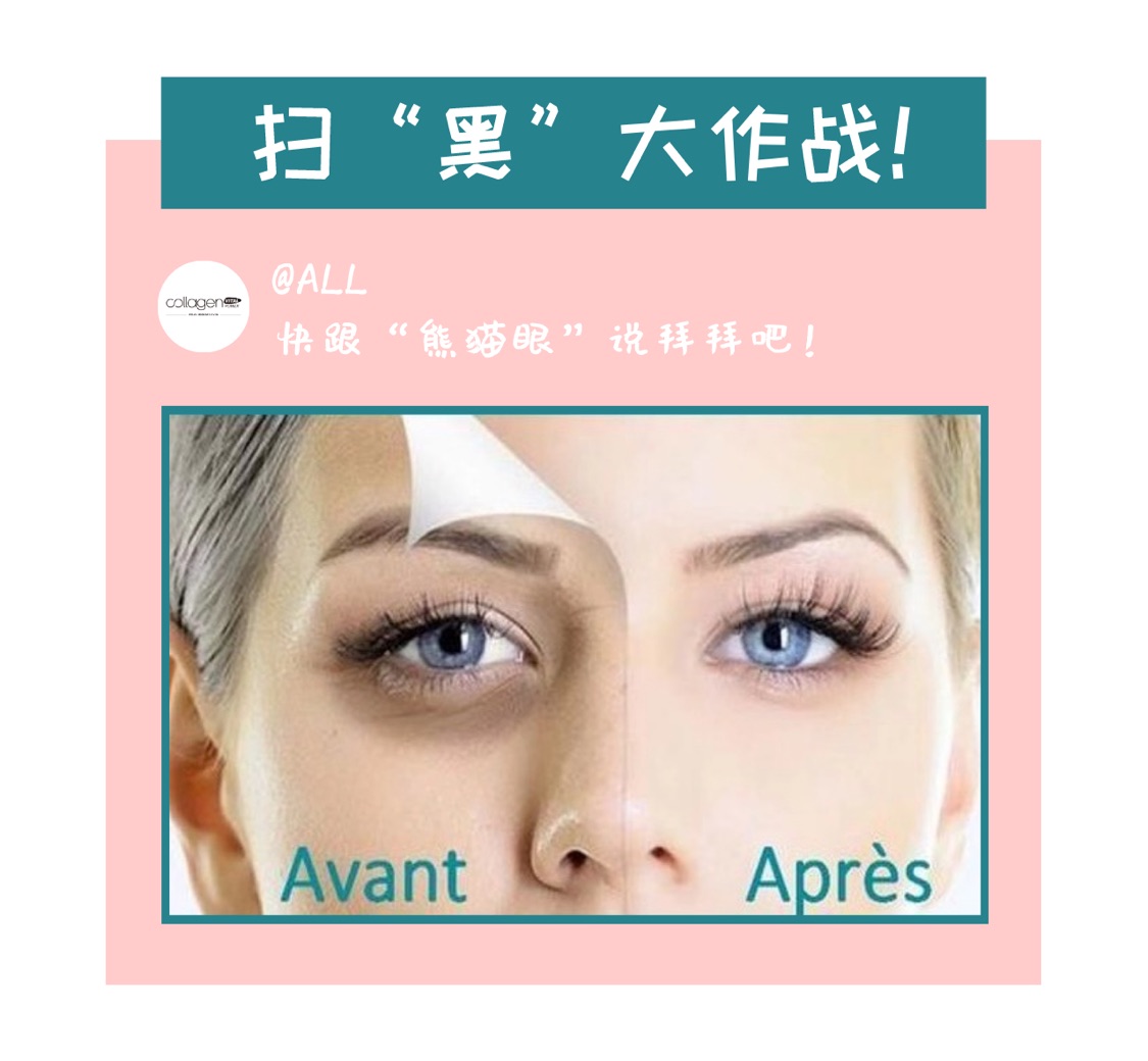 扫“黑”大作战！快跟“熊猫眼”说拜拜！