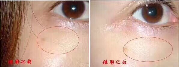 关于海蓝之谜的眼霜