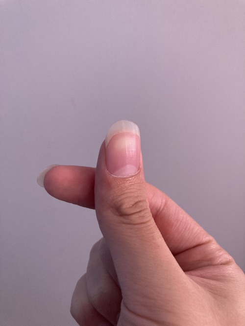 收破烂嘞