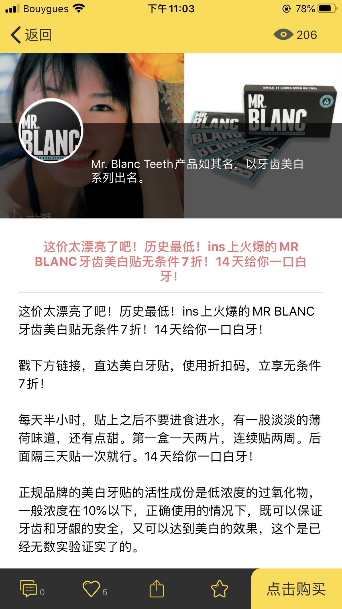 有没有小伙伴分享一下牙贴使用感？