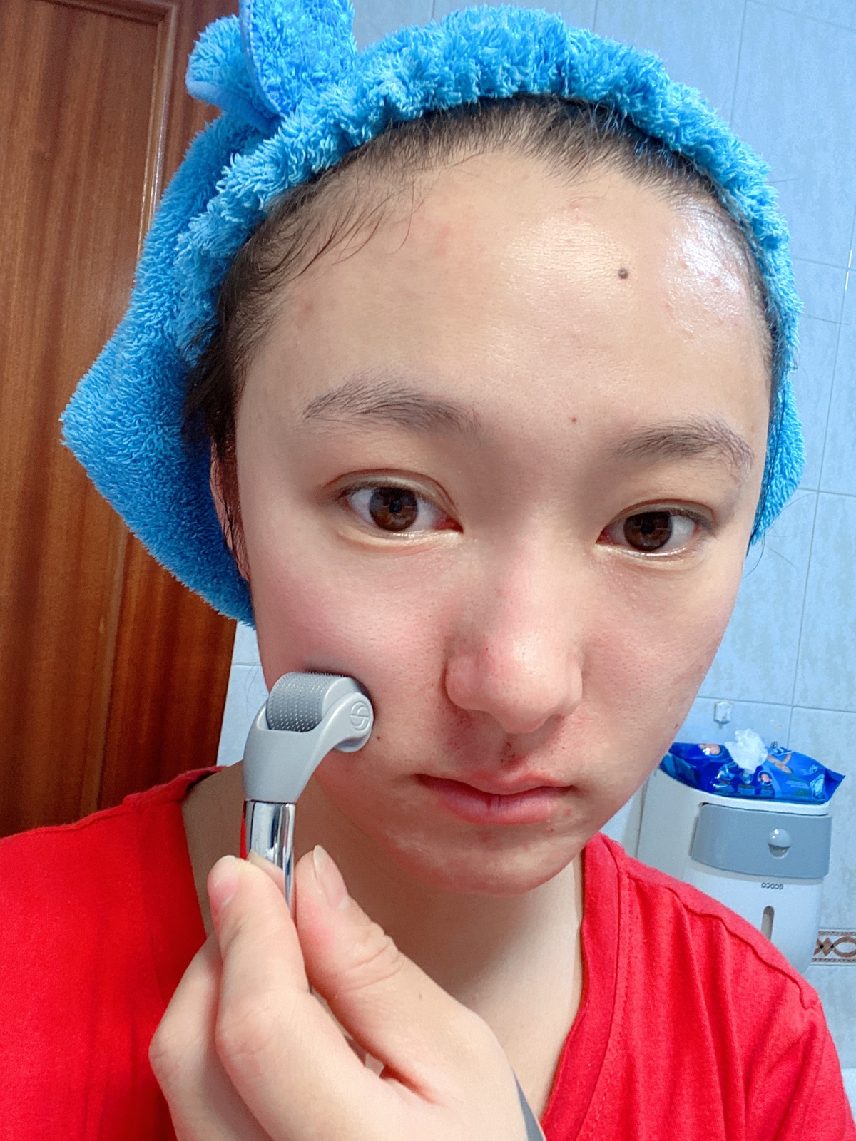 微针体验篇