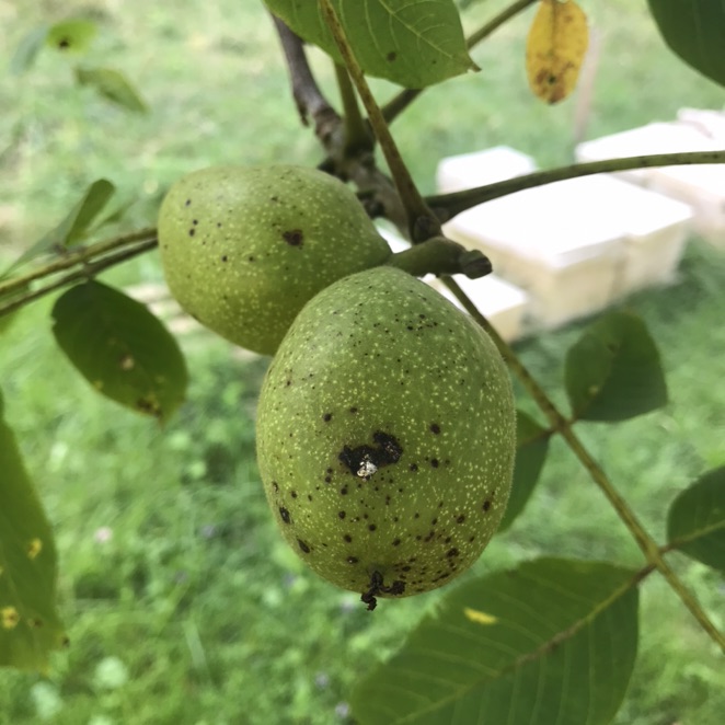 救救孩子！大块头皮屑
