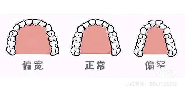 巴黎有没有推荐的正畸医生啊