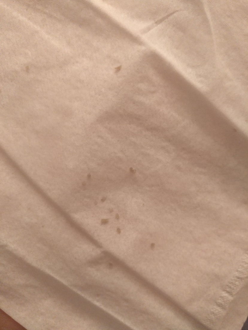 来说说风很大的白吸盘