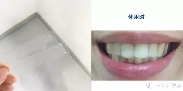两款牙贴